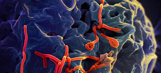 ebola-virus-attacking-cells